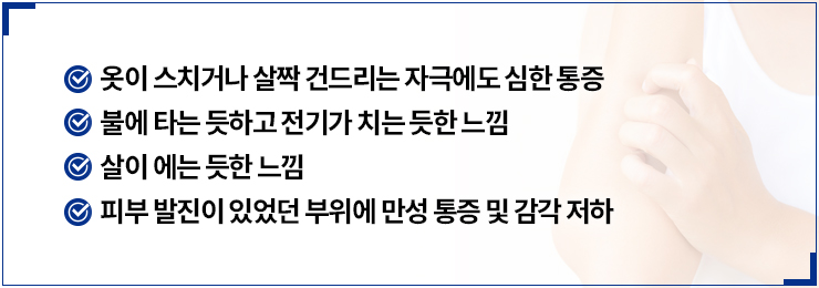 대상포진 신경통 증상